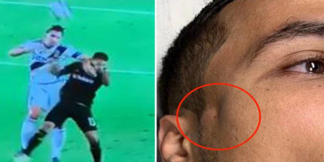 صورة إبراهيموفيتش يتسبب في إصابة لاعب ليبي بكسر على مستوى جمجمته